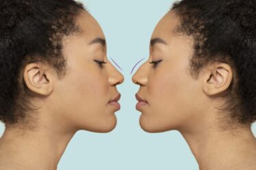 Kvinna som utfört näsplastik